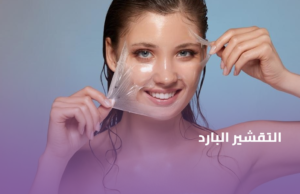 التقشير البارد